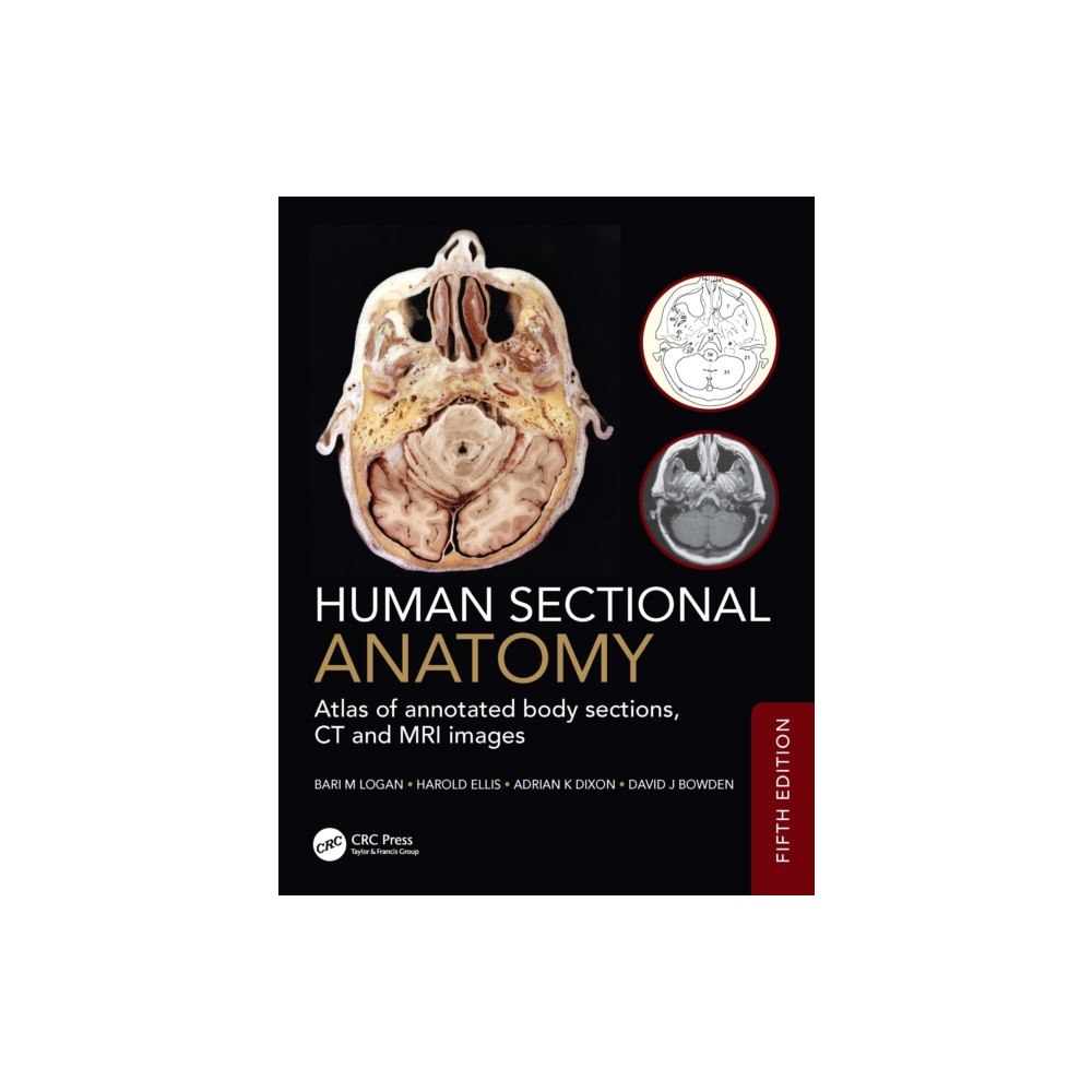 Taylor & francis ltd Human Sectional Anatomy (inbunden, eng)