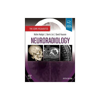 Elsevier - Health Sciences Division Neuroradiology (häftad, eng)