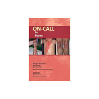 Libri Publishing On-Call in Burns (häftad, eng)