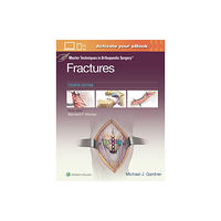 Wolters Kluwer Health Master Techniques in Orthopaedic Surgery: Fractures (inbunden, eng)