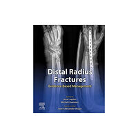 Elsevier - Health Sciences Division Distal Radius Fractures (inbunden, eng)