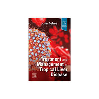 Elsevier - Health Sciences Division Treatment and Management of Tropical Liver Disease (häftad, eng)