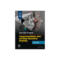 Elsevier - Health Sciences Division Specialty Imaging: Temporomandibular Joint and Sleep-Disordered Breathing (inbunden, eng)