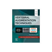 Elsevier - Health Sciences Division Vertebral Augmentation Techniques (inbunden, eng)