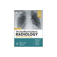 Elsevier Health Sciences The Unofficial Guide to Radiology: 100 Practice Chest X-rays (häftad, eng)