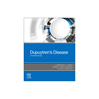 Elsevier Health Sciences Dupuytren's Disease (häftad, eng)