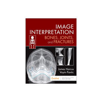 Elsevier - Health Sciences Division Image Interpretation: Bones, Joints, and Fractures (häftad, eng)