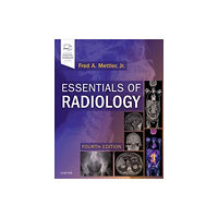 Elsevier - Health Sciences Division Essentials of Radiology (häftad, eng)