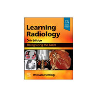 Elsevier - Health Sciences Division Learning Radiology (häftad, eng)