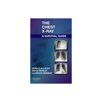 Elsevier Health Sciences The Chest X-Ray: A Survival Guide (häftad, eng)