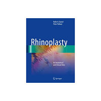 Springer International Publishing AG Rhinoplasty (inbunden, eng)