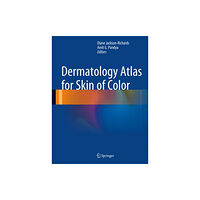 Springer-Verlag Berlin and Heidelberg GmbH & Co. K Dermatology Atlas for Skin of Color (inbunden, eng)