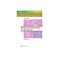 Lippincott Williams and Wilkins Biopsy Interpretation of the Breast (inbunden, eng)