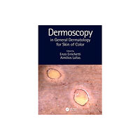 Taylor & francis ltd Dermoscopy in General Dermatology for Skin of Color (inbunden, eng)