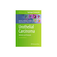 Springer-Verlag New York Inc. Urothelial Carcinoma (inbunden, eng)