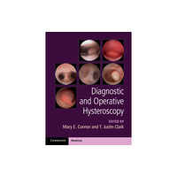 Cambridge University Press Diagnostic and Operative Hysteroscopy (inbunden, eng)