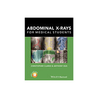 John Wiley And Sons Ltd Abdominal X-rays for Medical Students (häftad, eng)