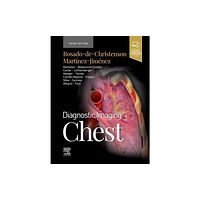 Elsevier - Health Sciences Division Diagnostic Imaging: Chest (inbunden, eng)