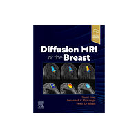 Elsevier - Health Sciences Division Diffusion MRI of the Breast (häftad, eng)