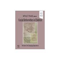 Elsevier - Health Sciences Division Facial Deformities in Children (inbunden, eng)