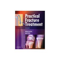 Elsevier Health Sciences Practical Fracture Treatment (häftad, eng)