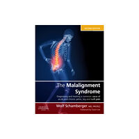 Elsevier Health Sciences The Malalignment Syndrome (inbunden, eng)