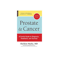 Hachette Books Prostate and Cancer (häftad, eng)