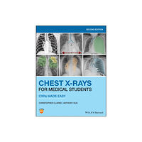 John Wiley And Sons Ltd Chest X-Rays for Medical Students (häftad, eng)