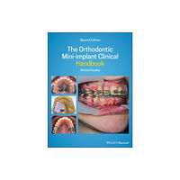 John Wiley And Sons Ltd The Orthodontic Mini-implant Clinical Handbook (inbunden, eng)