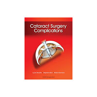 Taylor & francis inc Cataract Surgery Complications (inbunden, eng)