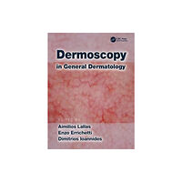 Taylor & francis ltd Dermoscopy in General Dermatology (inbunden, eng)