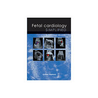 TFM Publishing Ltd Fetal Cardiology Simplified (häftad, eng)