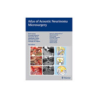 Thieme Publishing Group Atlas of Acoustic Neurinoma Microsurgery (inbunden, eng)