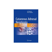 Springer International Publishing AG Cutaneous Adnexal Neoplasms (inbunden, eng)