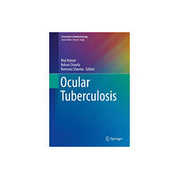 Springer International Publishing AG Ocular Tuberculosis (inbunden, eng)