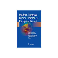 Springer International Publishing AG Modern Thoraco-Lumbar Implants for Spinal Fusion (häftad, eng)