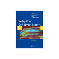 Springer-Verlag Berlin and Heidelberg GmbH & Co. K Imaging of Soft Tissue Tumors (häftad, eng)