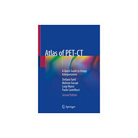 Springer-Verlag Berlin and Heidelberg GmbH & Co. K Atlas of PET-CT (häftad, eng)