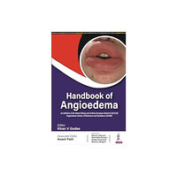 Jaypee Brothers Medical Publishers Handbook of Angioedema (häftad, eng)