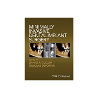 John Wiley And Sons Ltd Minimally Invasive Dental Implant Surgery (inbunden, eng)