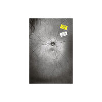 Fillip Supplement 3: The Invention and Conclusion of the Eye (häftad, eng)