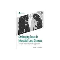 Taylor & francis ltd Challenging Cases in Interstitial Lung Diseases (häftad, eng)