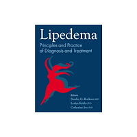 Hammersmith Health Books Lipedema (häftad, eng)