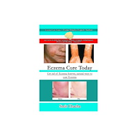 Lulu.com Eczema Cure Today - Get rid of Eczema forever natural ways to cure Eczema (häftad, eng)
