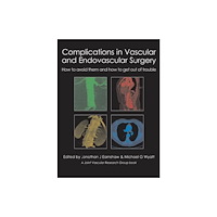 TFM Publishing Ltd Complications in Vascular and Endovascular Surgery (inbunden, eng)