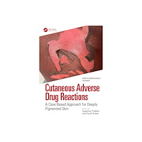 Taylor & francis ltd Cutaneous Adverse Drug Reactions (häftad, eng)