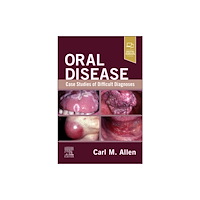 Elsevier Health Sciences Oral Disease: Case Studies of Difficult Diagnoses (häftad, eng)