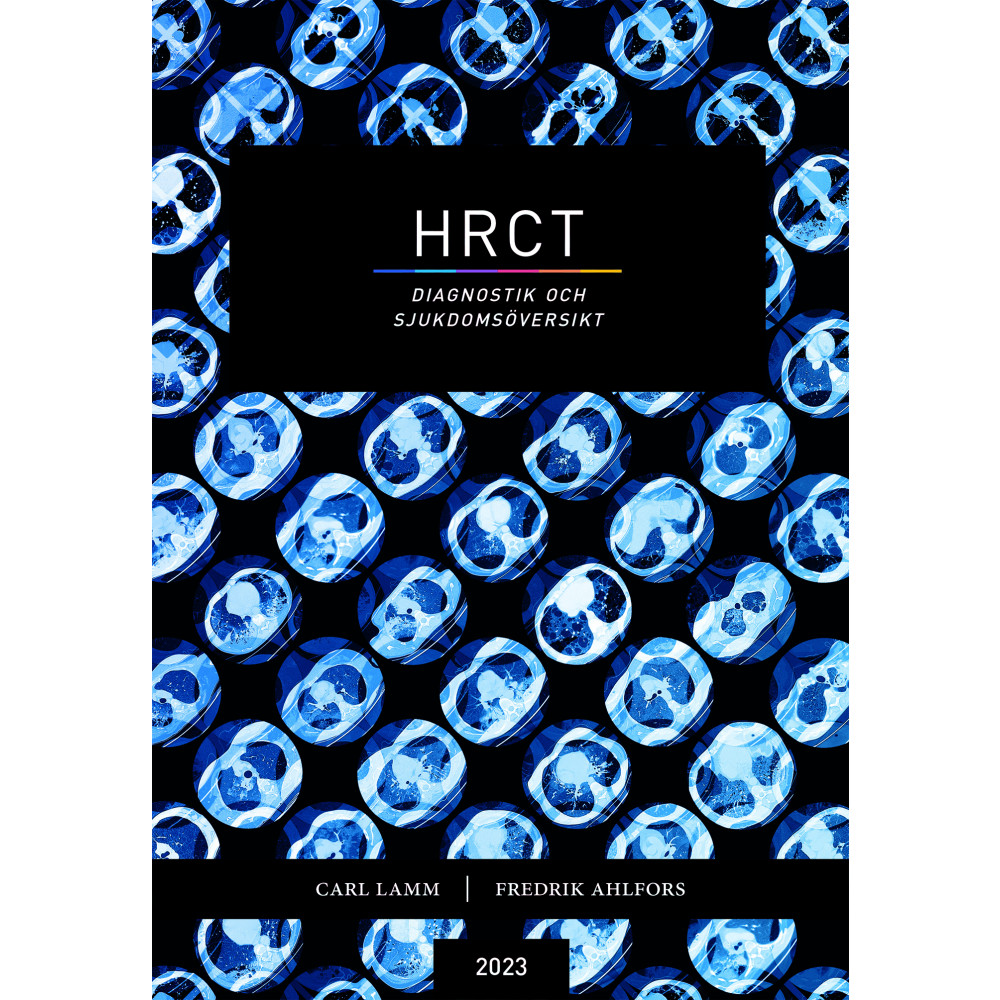 HRCT : diagnostik och sjukdomsöversikt (bok, danskt band) Carl Lamm