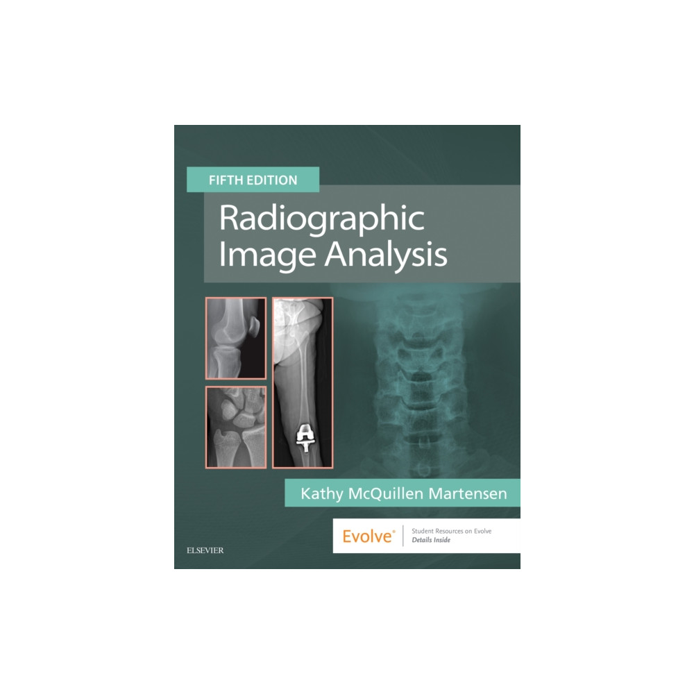 Radiographic Image Analysis (inbunden, english) Elsevier - Health Sciences Division