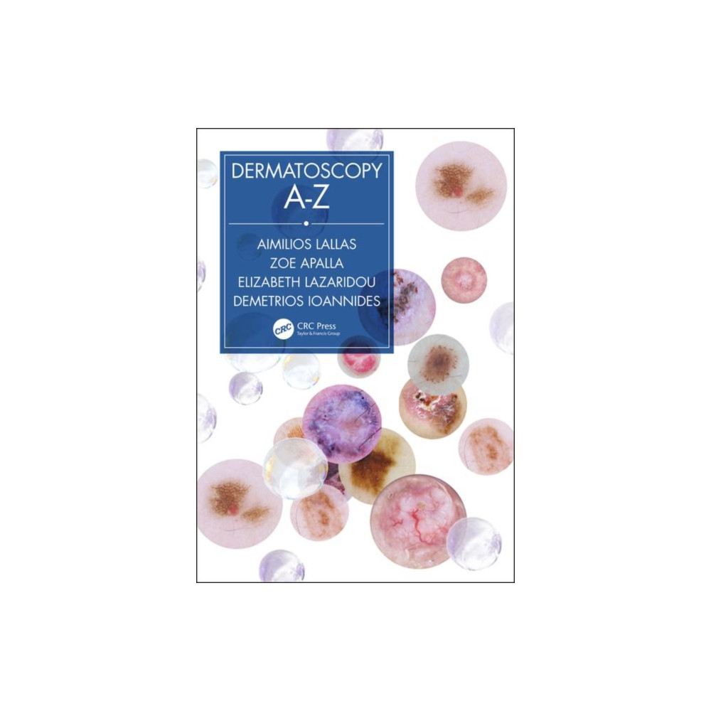 Dermatoscopy A-Z (häftad, english) Taylor & francis ltd